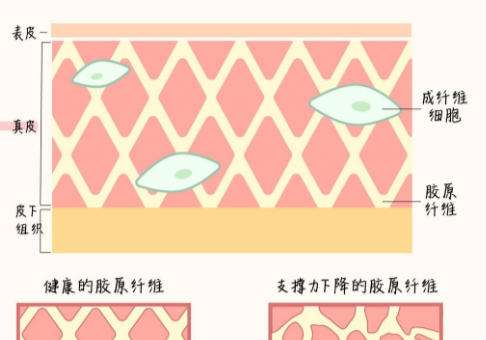 除皱.jpg