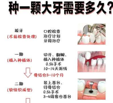 牙齿种植