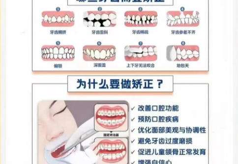 正颌1.jpg