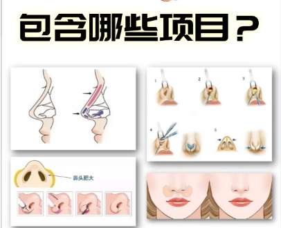 隆鼻