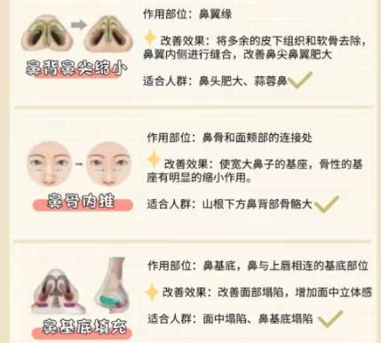 隆鼻 隆鼻
