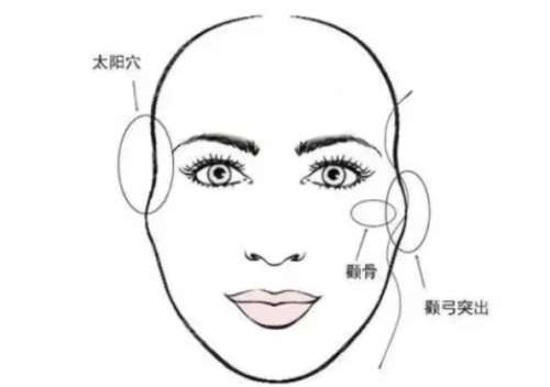 颧骨颧弓 颧骨颧弓