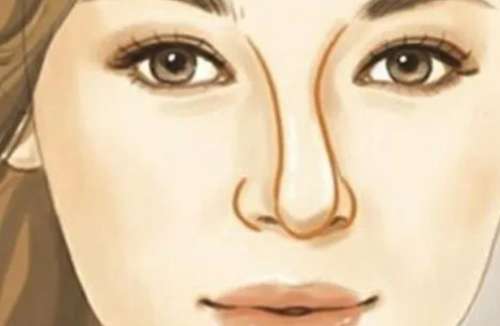 歪鼻矫正 歪鼻矫正