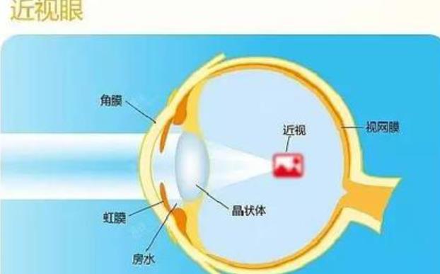 黔东南州人民医院眼科怎么样？李刚医生个人资料介绍！近视眼调节对比图分享