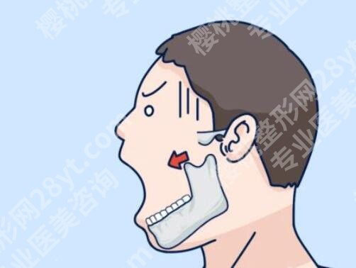 上海时光何晋龙磨骨多少钱?医生口碑测评及医生项目科普!