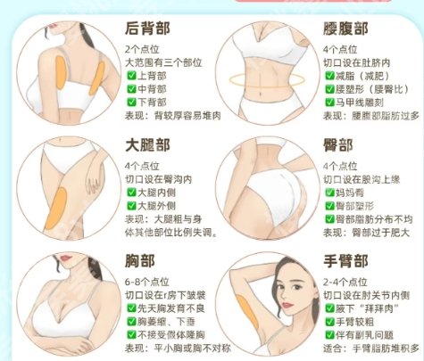刘照良吸脂技术如何?口碑高不高?实力精湛、值得信赖!