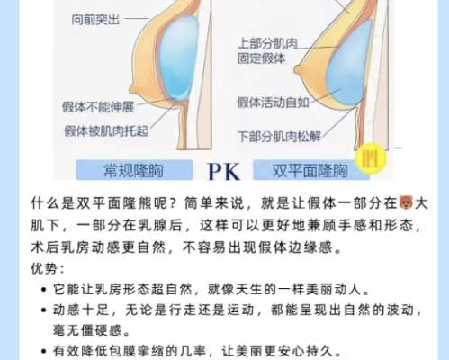 隆胸
