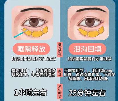 泪沟填充科普1.jpg