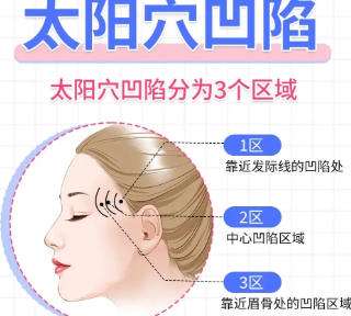 丰太阳穴