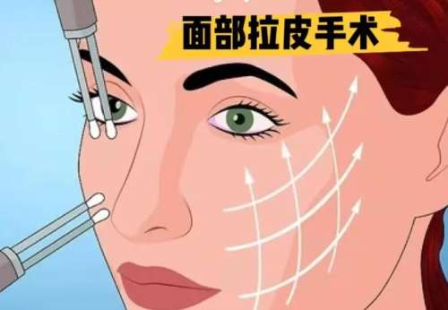 拉皮 拉皮
