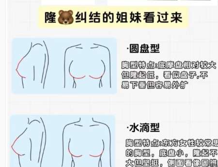 隆胸