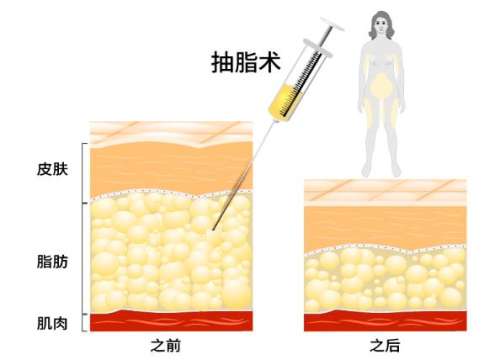 QQ截图20231103113824.jpg
