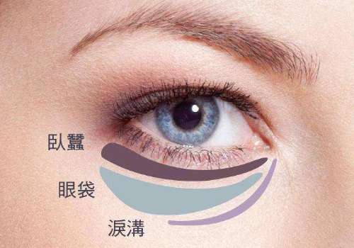 去眼袋3.jpg