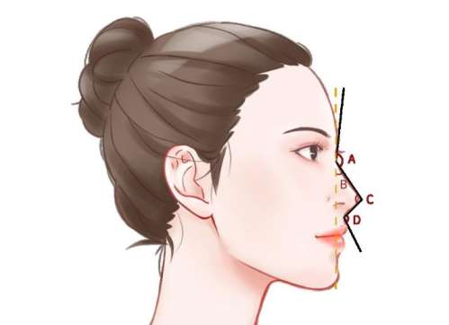 隆鼻动漫2.jpg 隆鼻动漫2.jpg