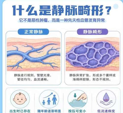 血管畸形.jpg 血管畸形.jpg