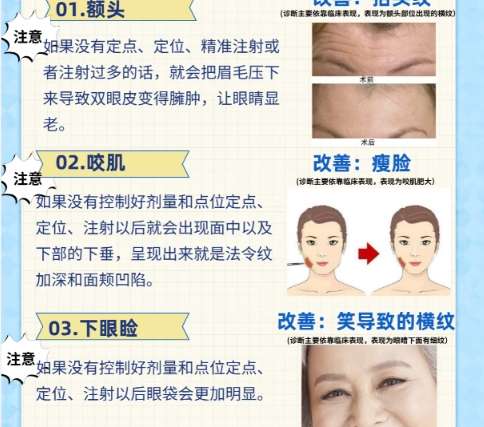 除皱
