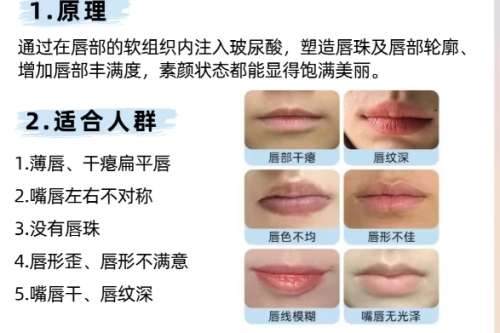 丰唇知识科普.jpg 丰唇知识科普.jpg
