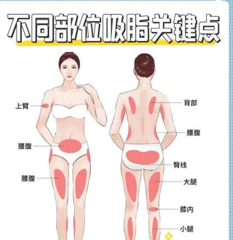 吸脂