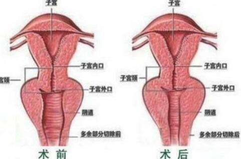 私密整形