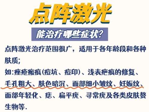点阵激光