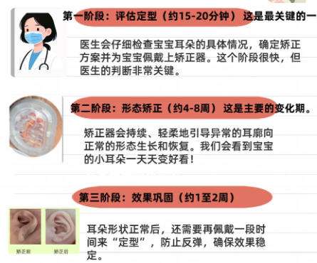 耳再造7.jpg