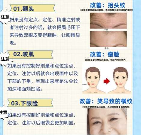 除皱