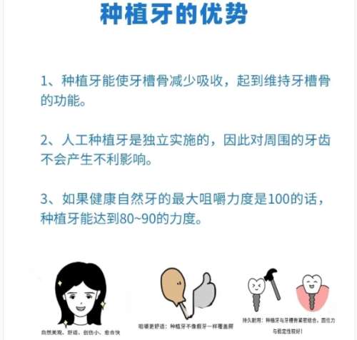 牙齿种植