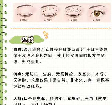 双眼皮