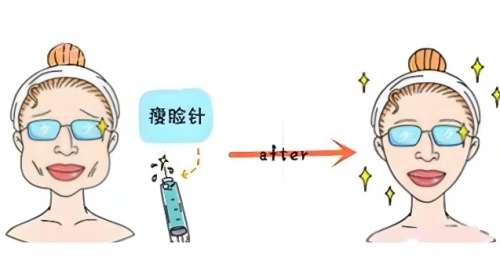面吸