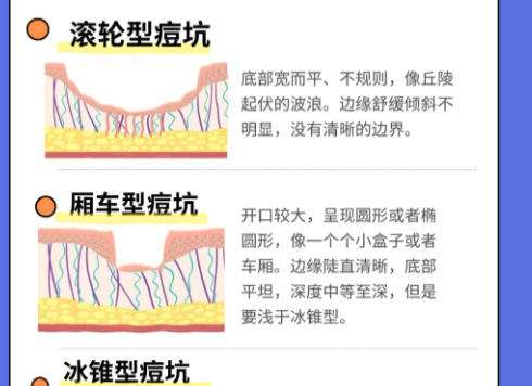 点阵激光2.jpg