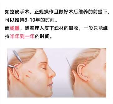 拉皮