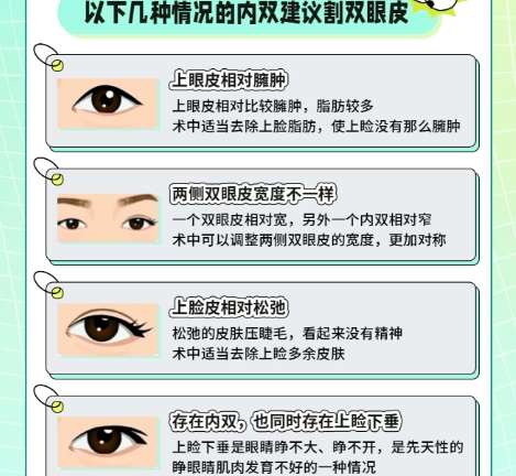 双眼皮