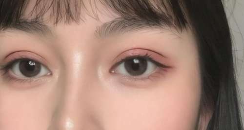 双眼皮