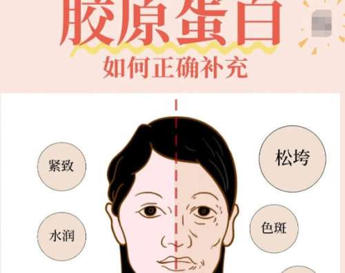 注射胶原蛋白