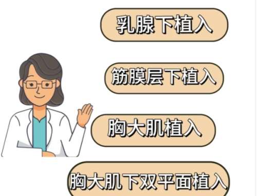 隆胸 隆胸