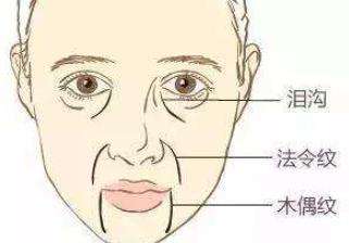 悬吊除皱动漫图01.jpg