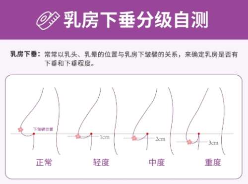 隆胸