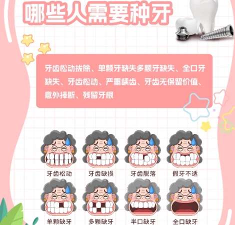 牙齿种植 牙齿种植