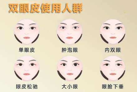 双眼皮 双眼皮