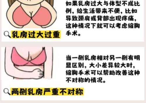 缩胸.jpg