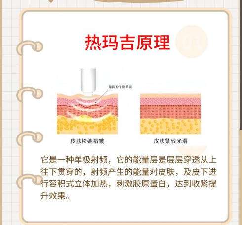 热玛吉.jpg