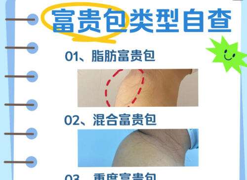 富贵包.jpg