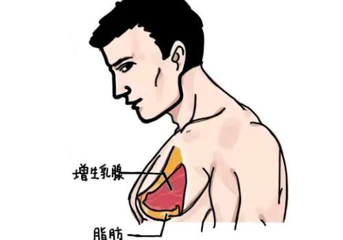 男性乳房.jpg