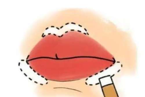 厚唇 厚唇