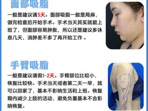 抽脂1.jpg 抽脂1.jpg