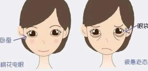 去眼袋动漫53.jpg 去眼袋动漫53.jpg