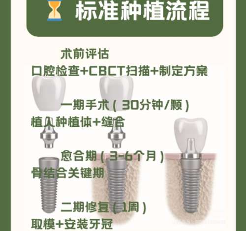 牙齿种植