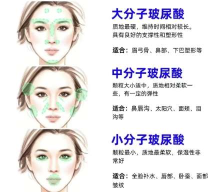 丰下巴