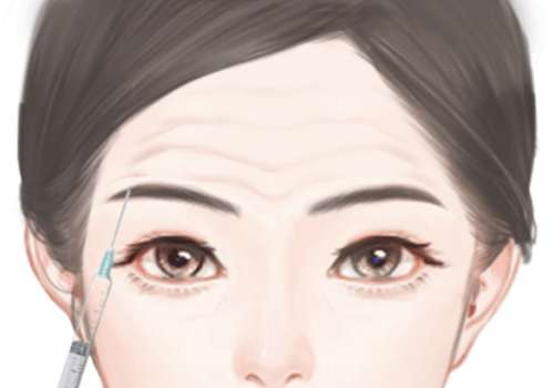 注射去抬头纹.jpg