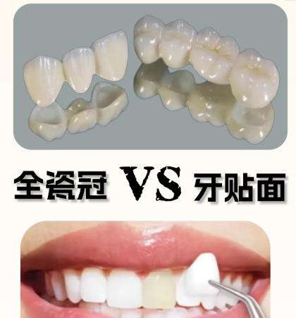 全瓷牙